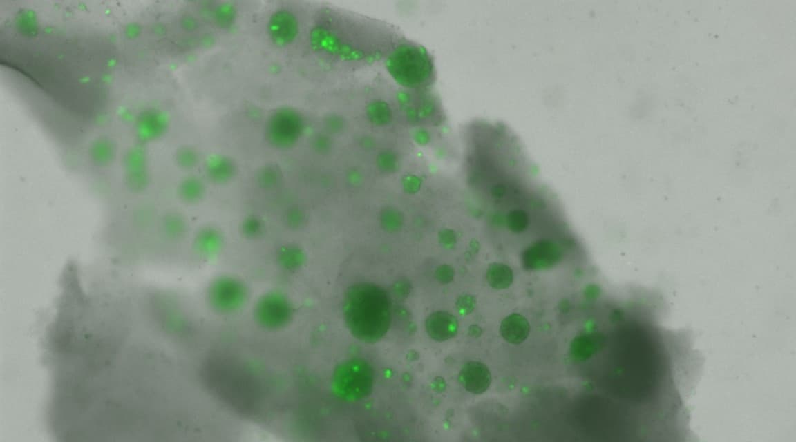 Das Mikroskopbild zeigt kleine, hellgrüne fluoreszierende Punkte, die über einen trüben grauen Hintergrund verstreut sind, was auf das Vorhandensein von markierten Zellen oder Partikeln hindeutet.