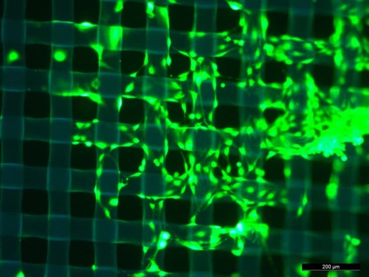 Ein mikroskopisches Bild, das ein grün fluoreszierendes Gittermuster mit unregelmäßigen, leuchtenden Formen auf dunklem Hintergrund zeigt. Der Skalenbalken in der unteren rechten Ecke zeigt 200 Mikrometer an.